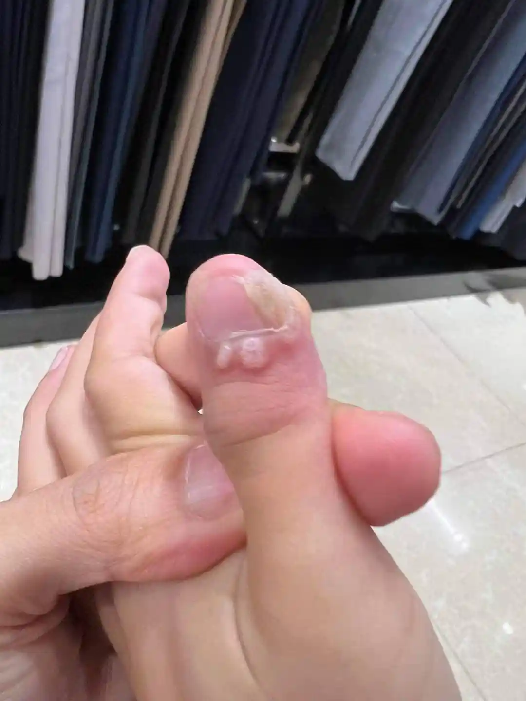 Ảnh thực tế phản hồi 1