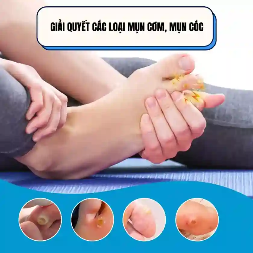 Mua 1 Hộp - Gói Dùng Thử